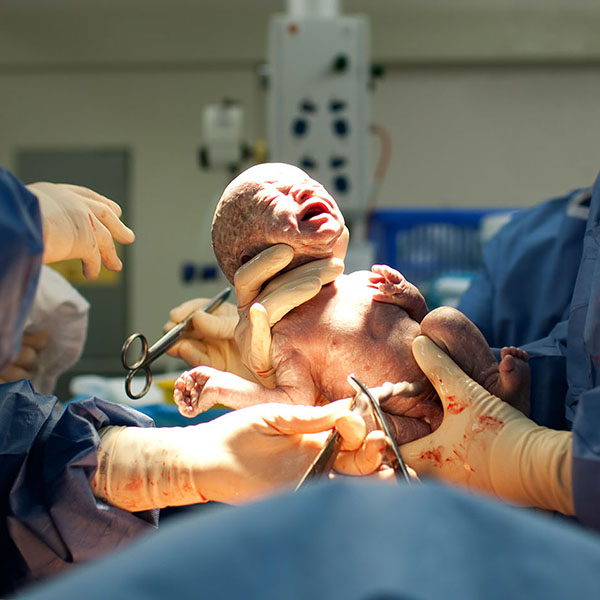 birth injury negligent childbirth infant brain damage medical negligence claims Accident Claims UK