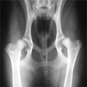 Claim hip injury compensation amounts