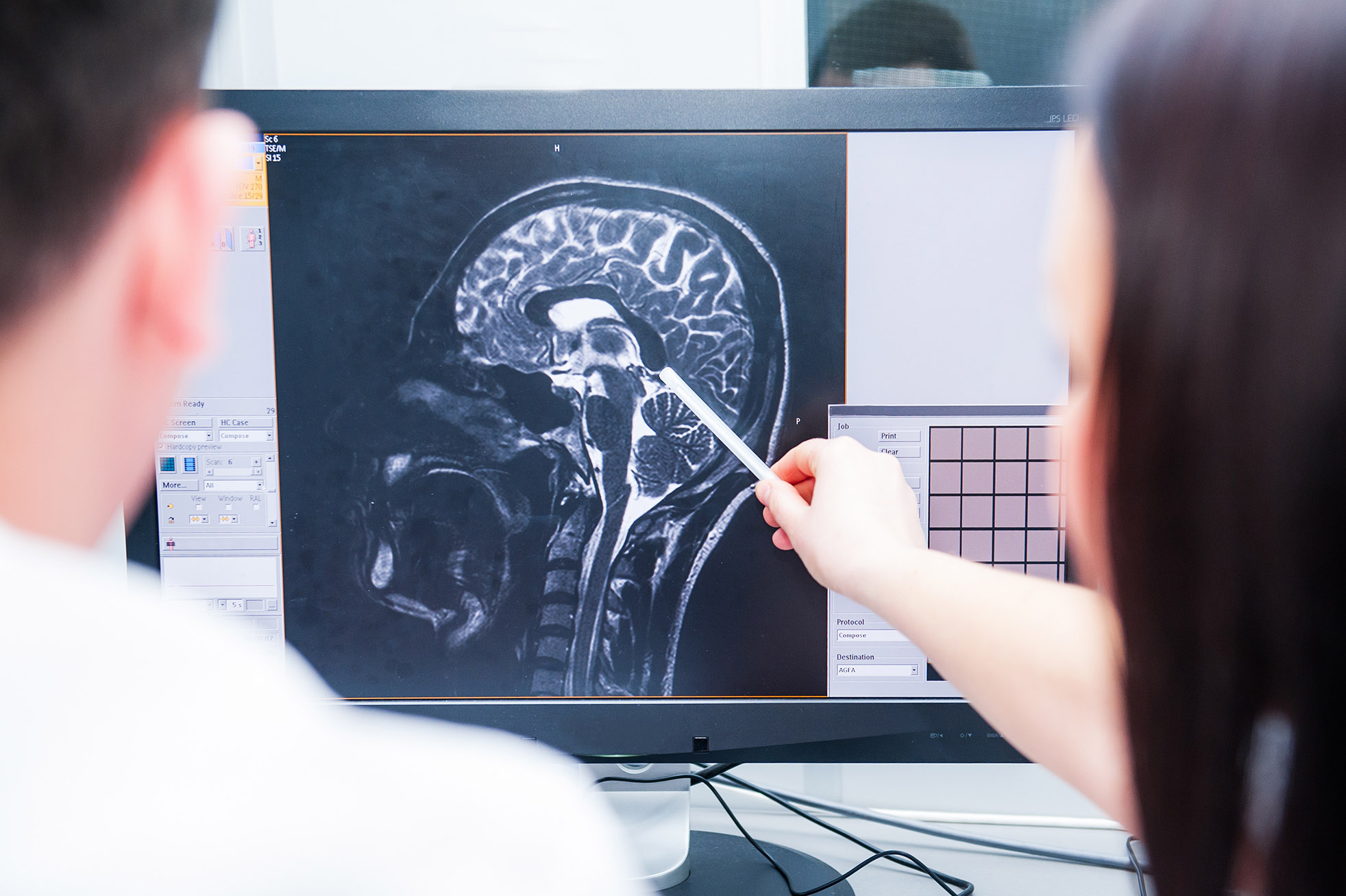 Doctors magnetic resonance image (MRI) injured brain, head injury