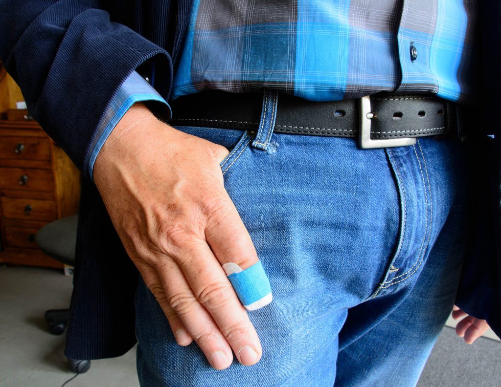 fingertip amputation