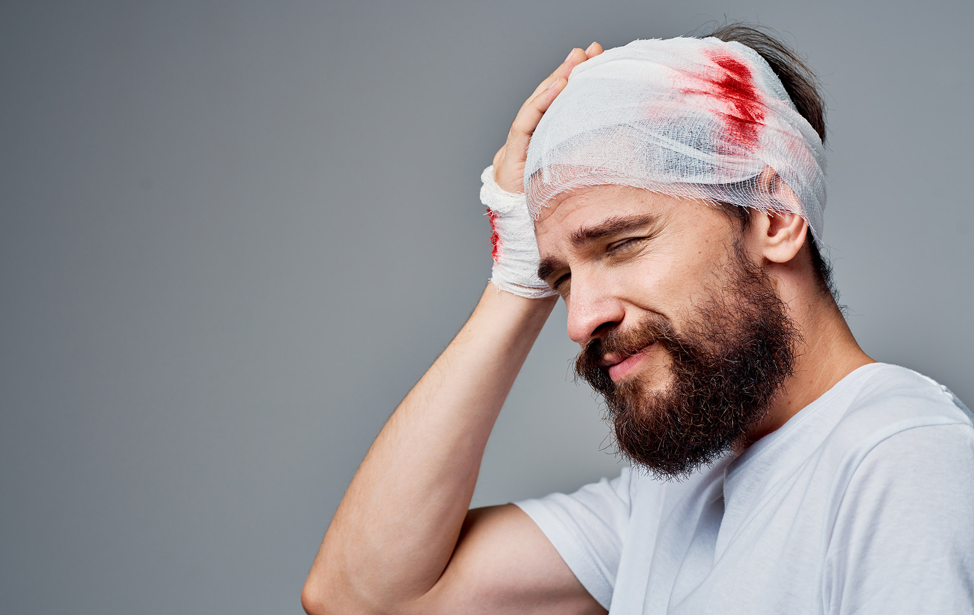 head injury compensation claim solicitors